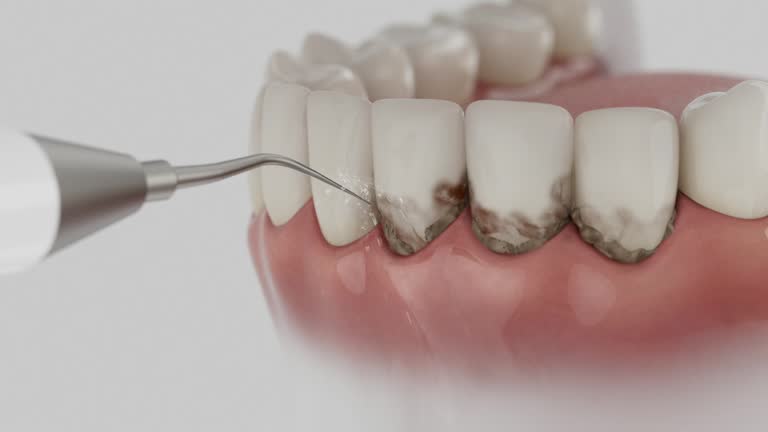 Reliable Dental Implants contractor in Rodeo, CA by Smile Center Dentistry